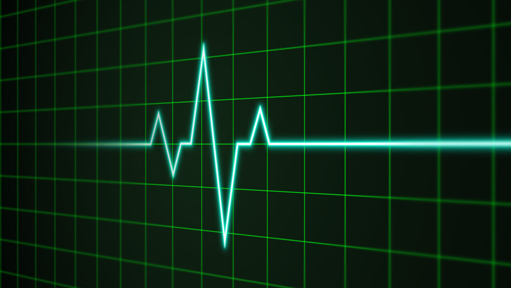 電気信号イメージ