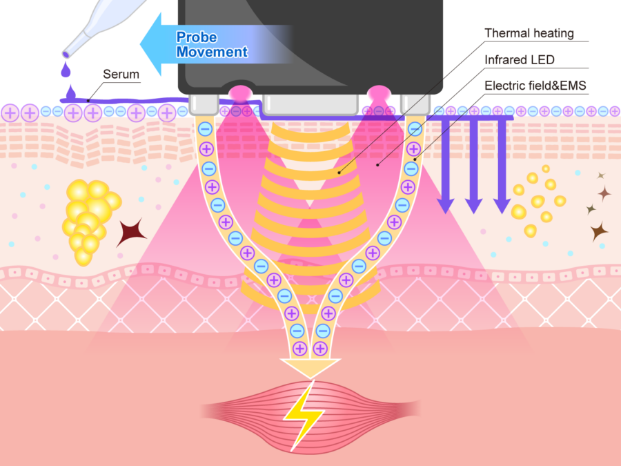 集束電場イメージ図