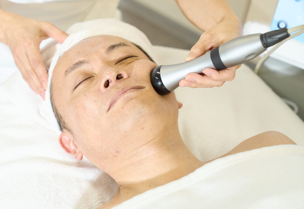 EFFプローブ施術