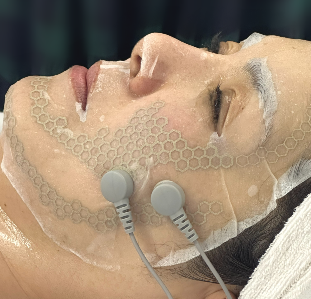 ハニカムAGマスク施術